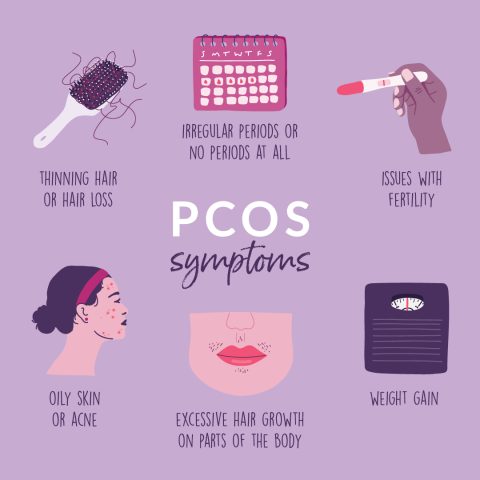 Infographic including different PCOS symptoms